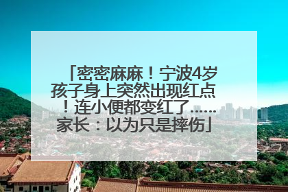 密密麻麻！宁波4岁孩子身上突然出现红点！连小便都变红了……家长：以为只是摔伤